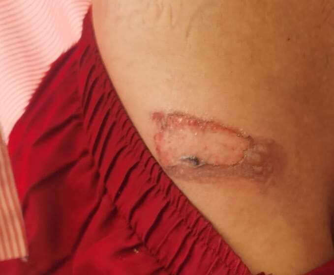 रोते हुए बोली मासूम.. बुआ मारती है, रोटी नहीं देती, मुझे घर मत भेजो