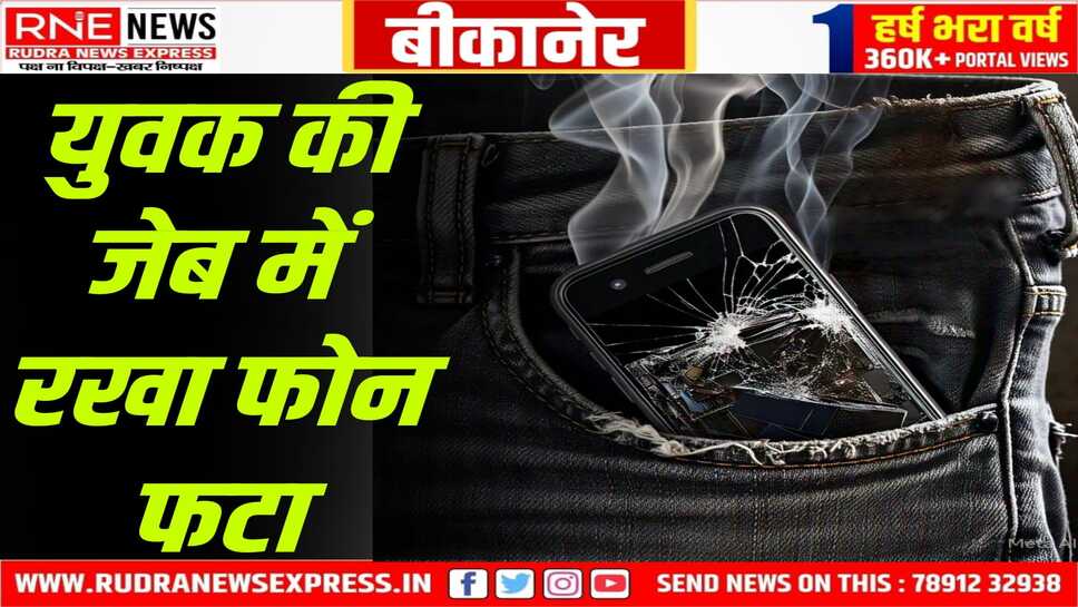Bikaner : जेब में फोन फटने से युवक की उंगलियों में गंभीर चोट