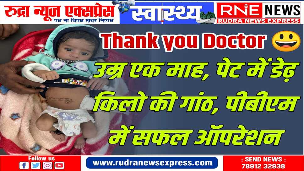 काईलस सिस्ट का जटिल ऑपरेशन छोटी आतं का हिस्सा भी निकाला, बच्चा ठीक