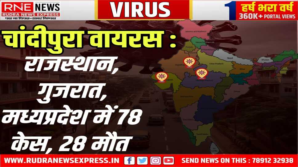 Chandipura Virus Alert - 78 रोगी- 28 मौत : मृतकों में 01 राजस्थान, 27 गुजरात के