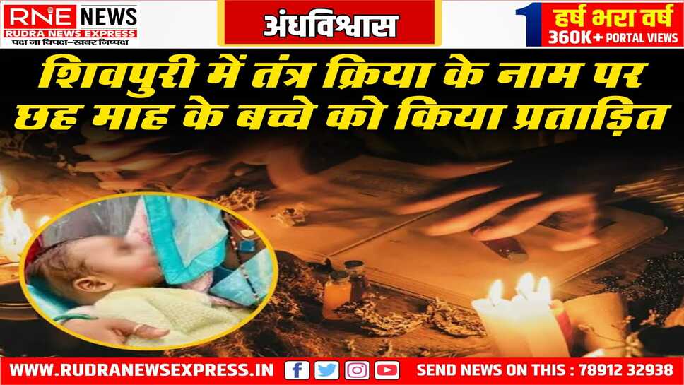 छह माह के बच्चे पर भूत का साया बताकर गाल - होंठ दागे, तांत्रिक के खिलाफ मुकदमा दर्ज हुआ, अंधविश्वास की पराकाष्ठा