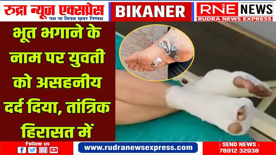 तांत्रिक पुलिस हिरासत में: युवती के हाथ-पांव में गर्म सलाखें लगाई, थपड़ जड़े, घूंसे मारे, हॉस्पिटल में भर्ती