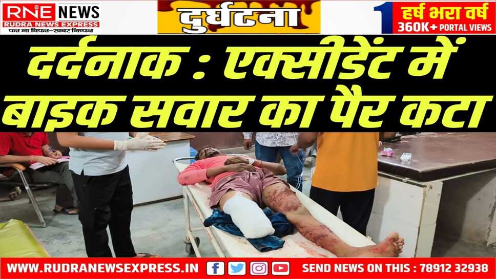 Khajuwala : युवक का पैर कटा, पैर को डिब्बे में रखकर हॉस्पिटल लाए