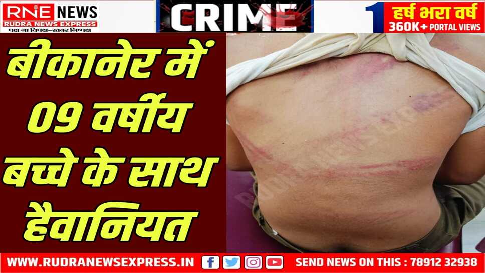 Deshnok : 09 साल के मासूम को लोहे के पाइप से पीटा, हालत गंभीर