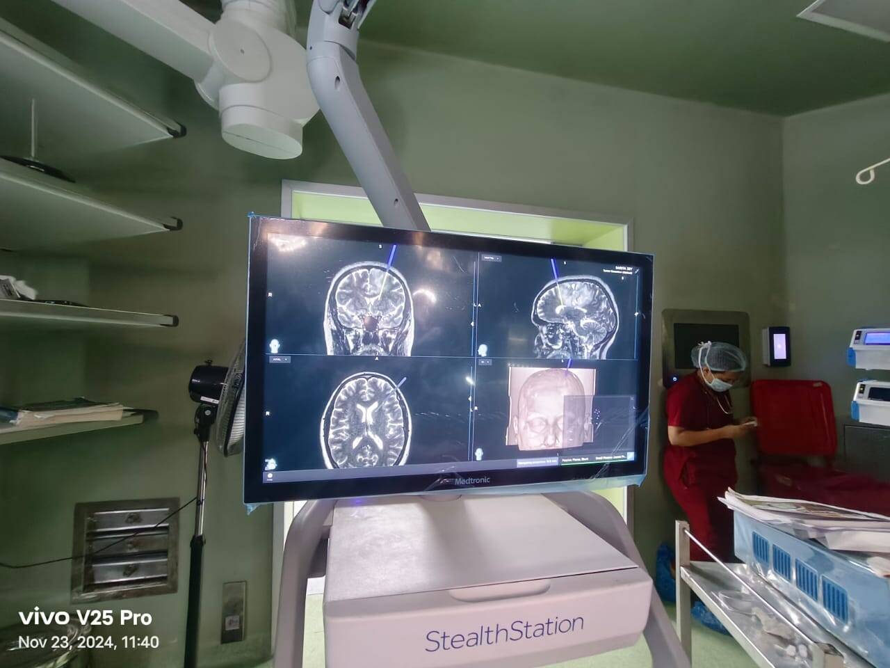 Awake Craniotomy in PBM : जागती हुई महिला से बातें करते, हाथ-पांव हिलाते कर दी ट्यूमर की जटिल सर्जरी