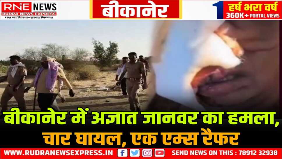 Khajuwala : अज्ञात जानवर ने महिला को नोंचा, एक का कान काटा, मां-बेटी सहित चार को घायल किया