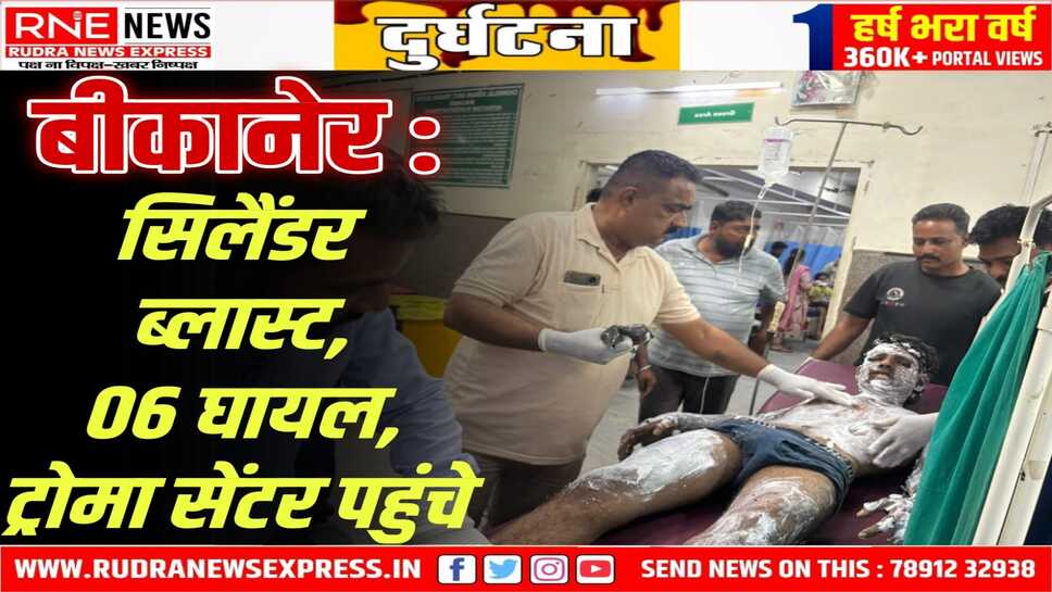 Nokha : ऑटो में अवैध गैस रिफलिंग करते ब्लास्ट, 06 घायलों का ट्रोमा सेंटर में इलाज