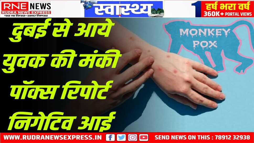 नागौर निवासी की मंकी पॉक्स की रिपोर्ट आई नेगेटिव