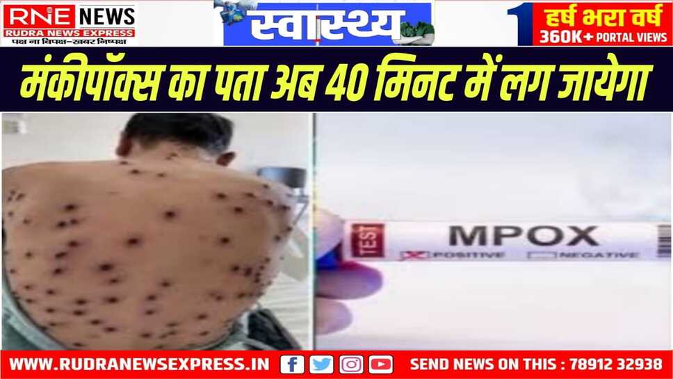 स्वदेशी कम्पनी सीमेंस हेल्थनियर्स ने बनाई पहली RT- PCR टेस्ट किट