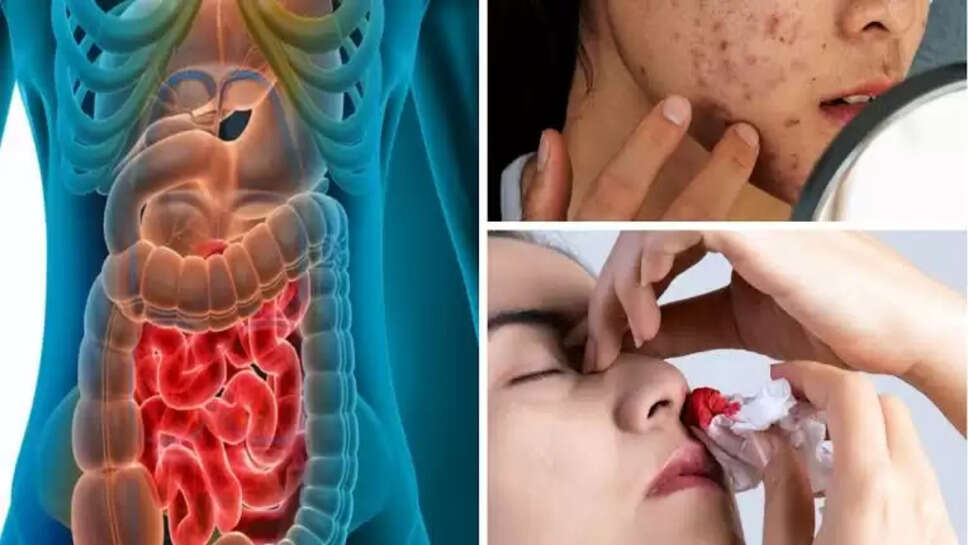 Liver cancer symptoms