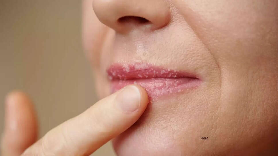 Health Tips  सर्दियों में होंठ फटने से परेशान है तो अपनाएं यह उपाय, होंठ बन जाएंगे मुलायम&nbsp;