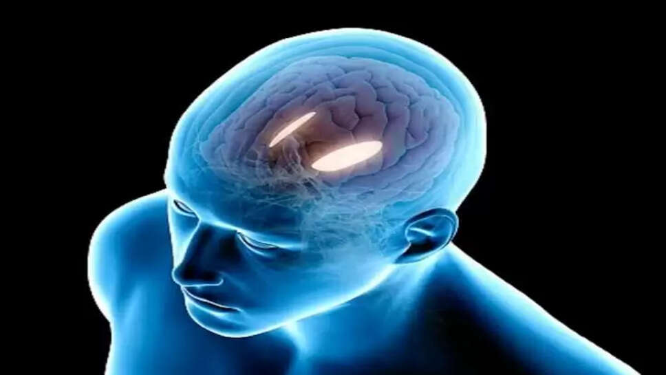 Migraine